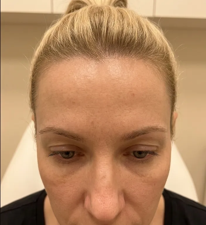 Muskelrelaxans nachher