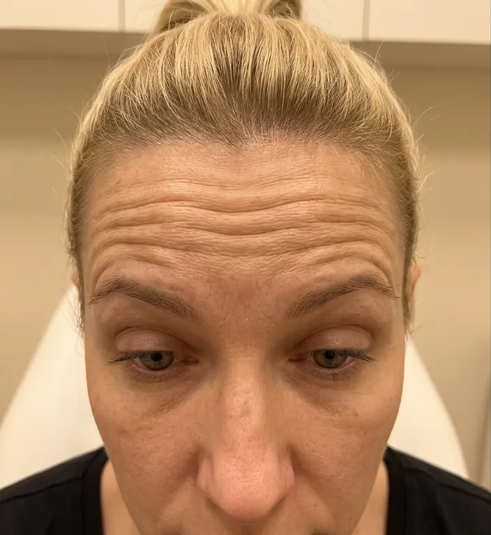 Muskelrelaxans vorher